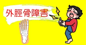 子供の外脛骨