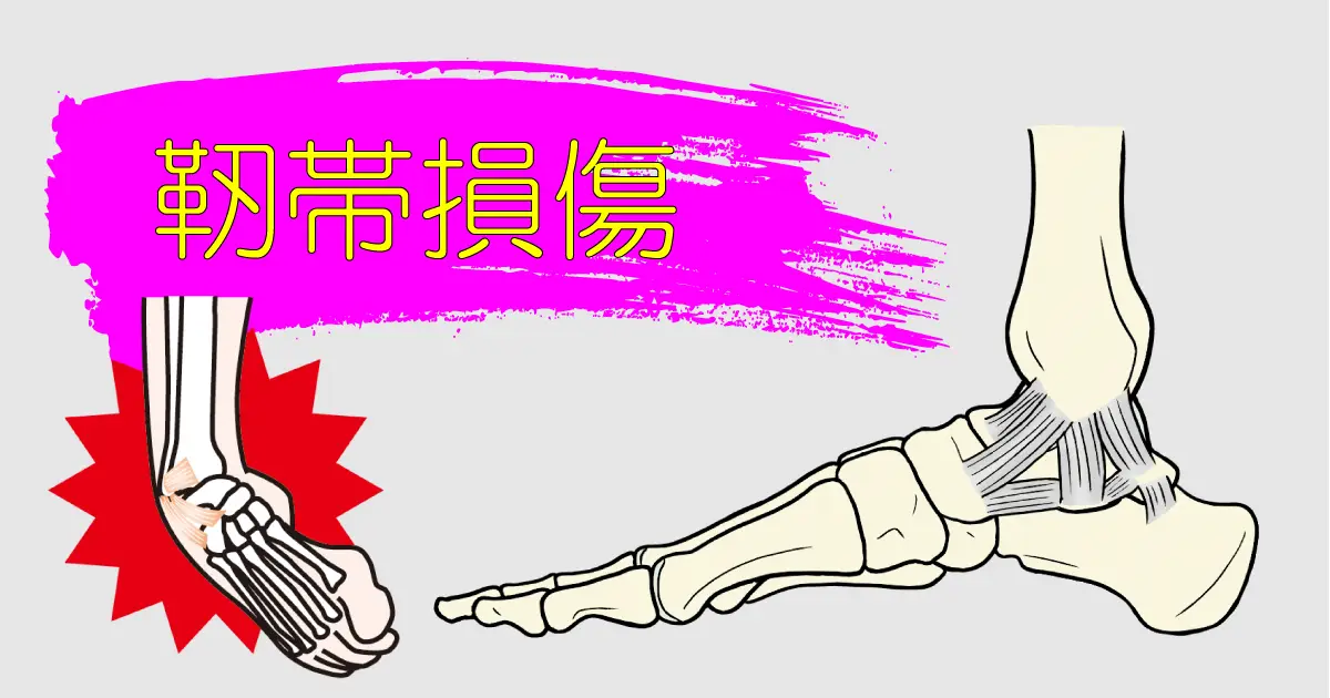 子供の靭帯損傷