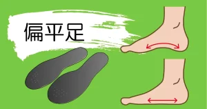 子供の偏平足